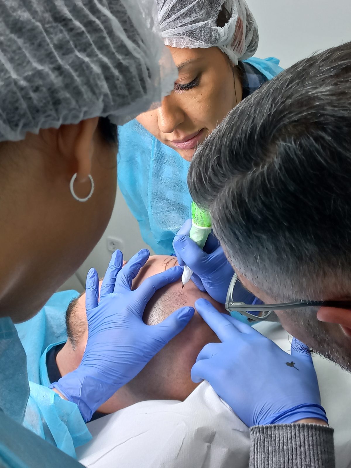 Sessione di formazione hands-on: docente Belfatto Lab guida il trainee durante un trattamento di tricopigmentazione su paziente reale